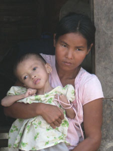 ミャンマーの被災地はいまだ復興がならず、栄養不足の子どもたちが苦しんでいます