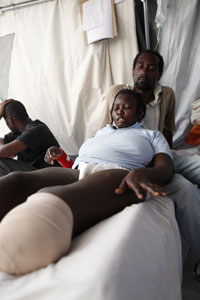 地震で左足を失った女性 地震で左足を失った女性