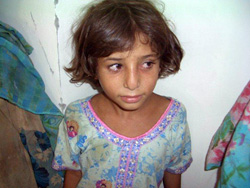 眼の感染症も拡大しています 目の診療を受けに来た少女